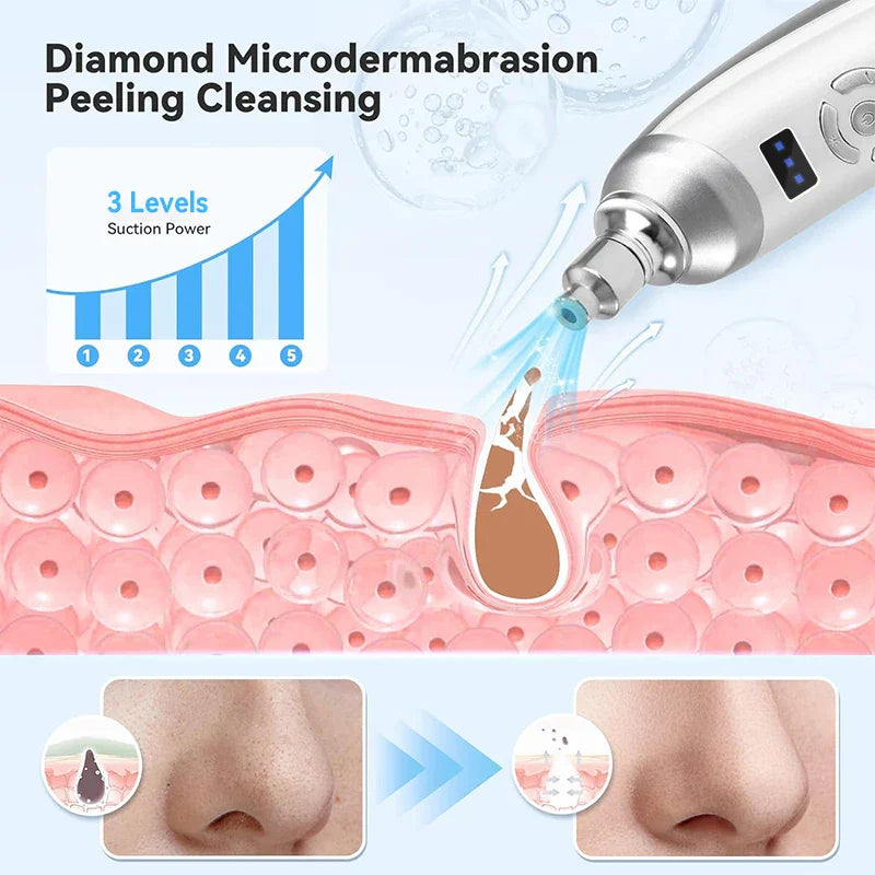 Upgraded Diamond Microdermabrasion Machine White-2